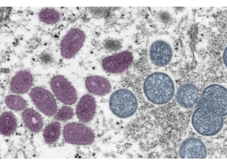 Second vaccine doses to be offered to those at highest risk from monkeypox – GOV.UK