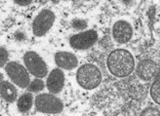 State expands eligibility for monkeypox vaccine | Delaware First Media – Delaware First Media