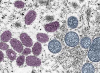 State health department expands monkeypox vaccine eligibility – Alaska Public Media News