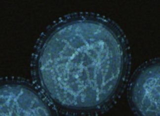 What you need to know about monkeypox – University of Pittsburgh