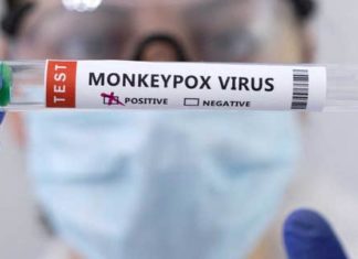 WHO allows public to help rename monkeypox, vows nothing ‘ridiculous’ – Fox News