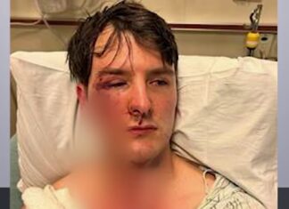 Attorney Calls for Hate Crime for Attack on Owners of Gay Bar Troupe429 – NBC New York & More Latest News – upjobsnews