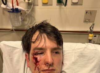 Couple attacked in gay bar finally get justice after going public – LGBTQ Nation