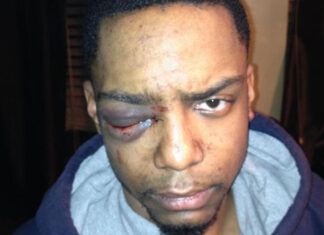 Judge awards $4.5 million to Black gay man who was beaten so brutally he lost vision in one eye – LGBTQ Nation