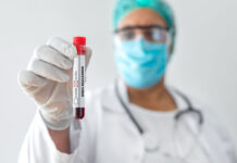 Monkeypox cases are in sharp decline. Could the outbreak be over? – Iowa Capital Dispatch