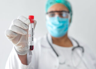 Monkeypox cases are in sharp decline. Could the outbreak be over? – Iowa Capital Dispatch