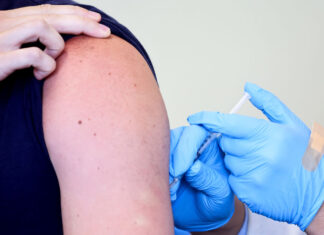 Monkeypox cases are in sharp decline. Could the outbreak be over? – Ohio Capital Journal