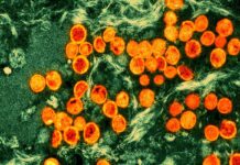 Monkeypox didn’t become a pandemic. Are we celebrating too soon? – Salon