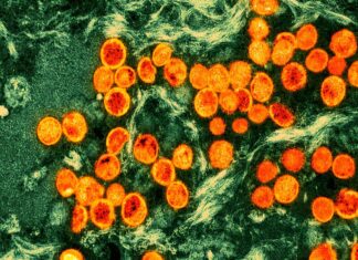 Monkeypox didn’t become a pandemic. Are we celebrating too soon? – Salon