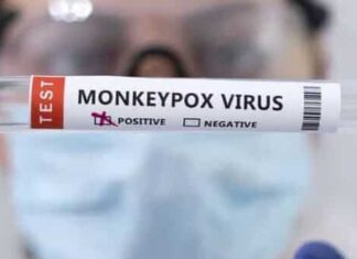 Was painful to…’: Gay man who had monkeypox shares experience. Watch | Mint – Mint