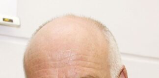 David Nabarro, U.N. Health Expert During Ebola and Covid, Dies at 75 - The New York Times