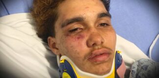 1 injured after gay couple attacked in Boston, police say - WCVB