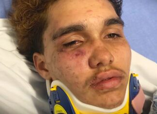 1 injured after gay couple attacked in Boston, police say - WCVB