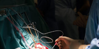 Jason Collins, NBA’s first openly gay player, undergoing treatment for brain tumor - The Athletic - The New York Times