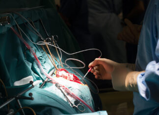 Jason Collins, NBA’s first openly gay player, undergoing treatment for brain tumor - The Athletic - The New York Times