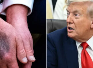 Trump’s MRI scan raises specter of secrecy in presidential health - The Hill