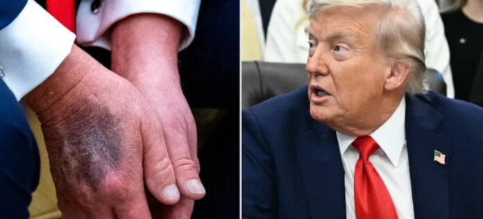 Trump’s MRI scan raises specter of secrecy in presidential health - The Hill