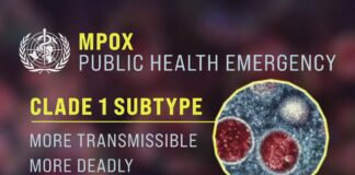 US public health officials vigilant as newer mpox variant detected - The Guardian