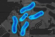 Deleted CDC Page: About Shigella Infection Among Gay, Bisexual, and Other Men Who Have Sex with Men - Men's Health